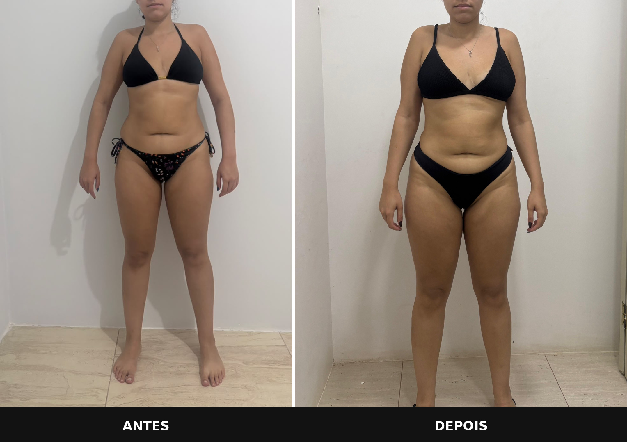 Comparativo 01 de antes e depois, vista frontal