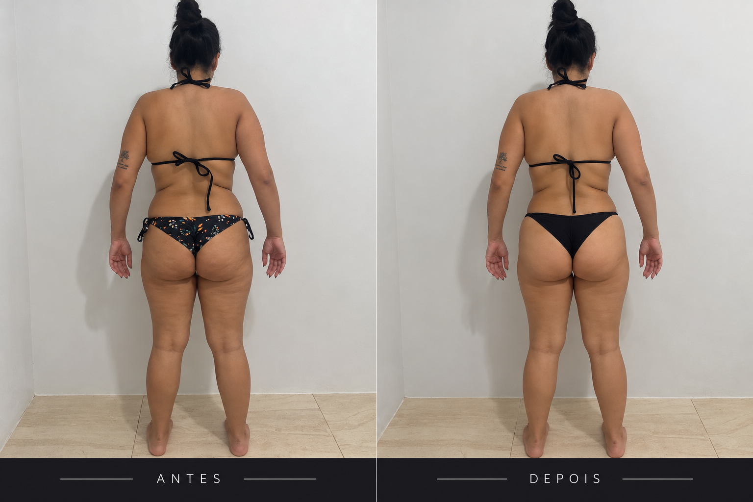 Comparativo 03 de antes e depois, vista costas