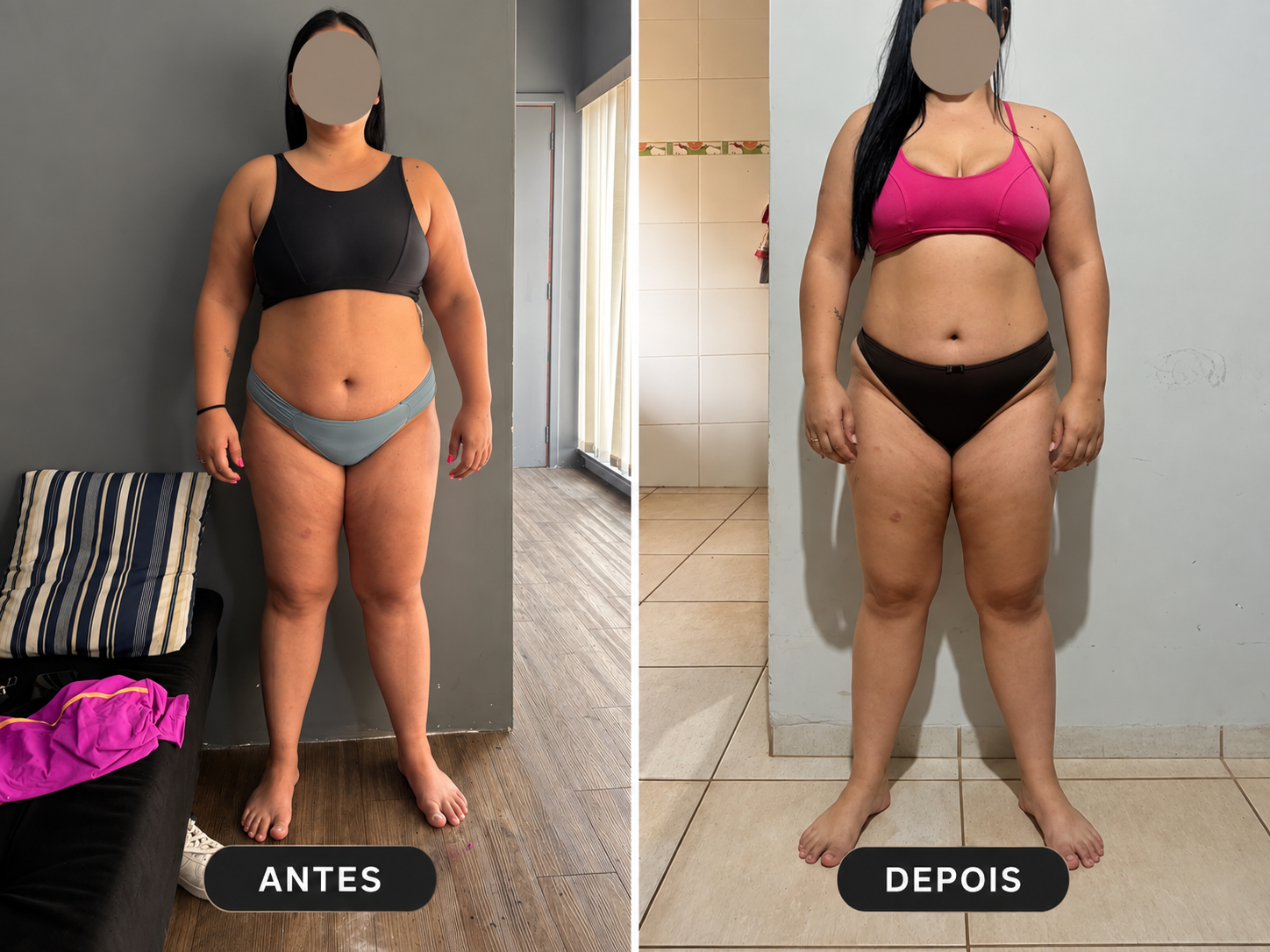 Comparativo 04 de antes e depois, vista frontal