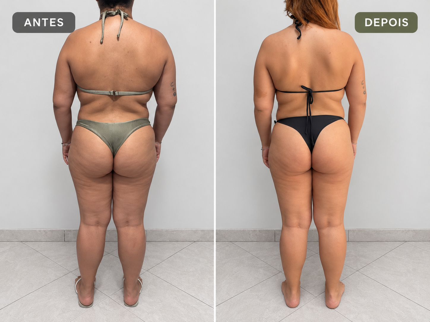 Comparativo 06 de antes e depois, vista costas