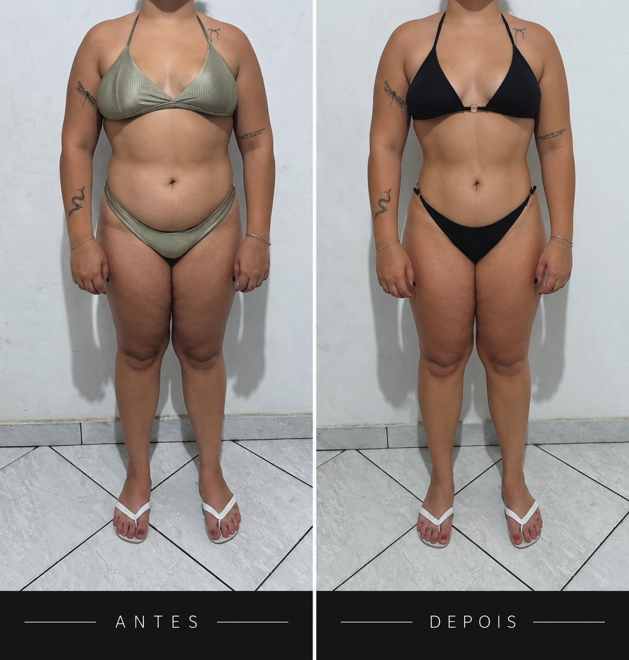 Comparativo 07 de antes e depois, vista frontal