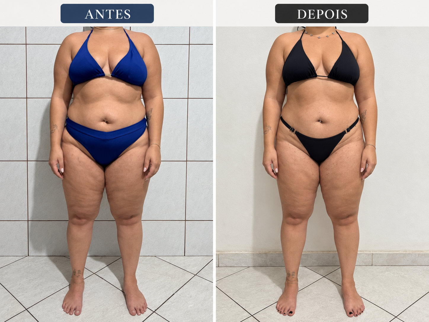 Comparativo 08 de antes e depois, vista frontal