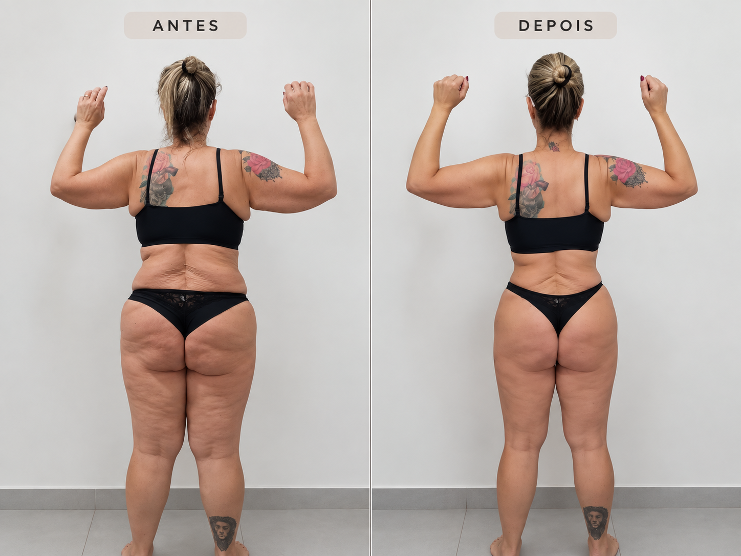 Comparativo 09 de antes e depois, vista costas