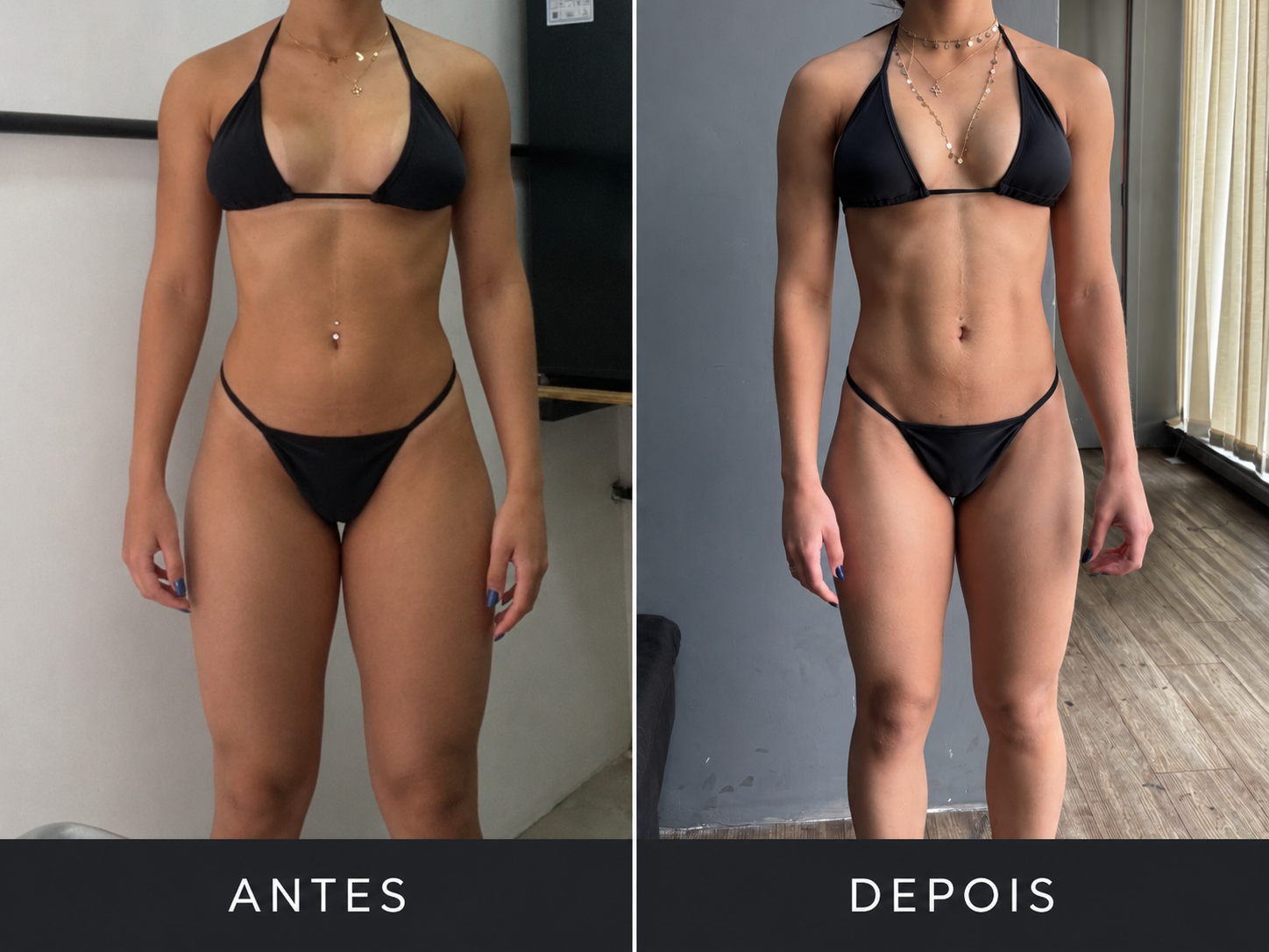 Comparativo 12 de antes e depois, vista frontal